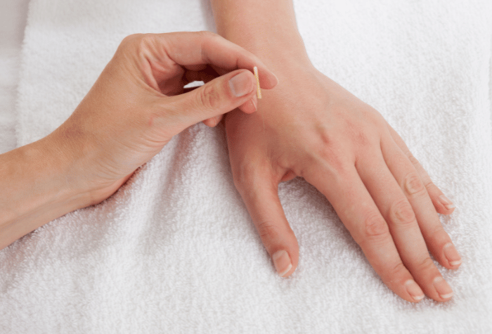 Ottawa acupuncture services follow up